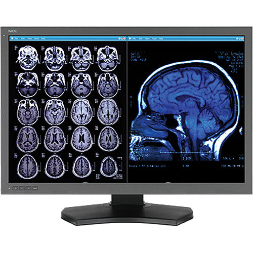 b315a6df3c8f40fb9f96b9fdb0273d4a