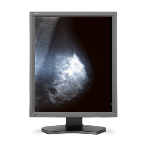 nec-md211g5-n1-21-5mp-medical-mammography-display-