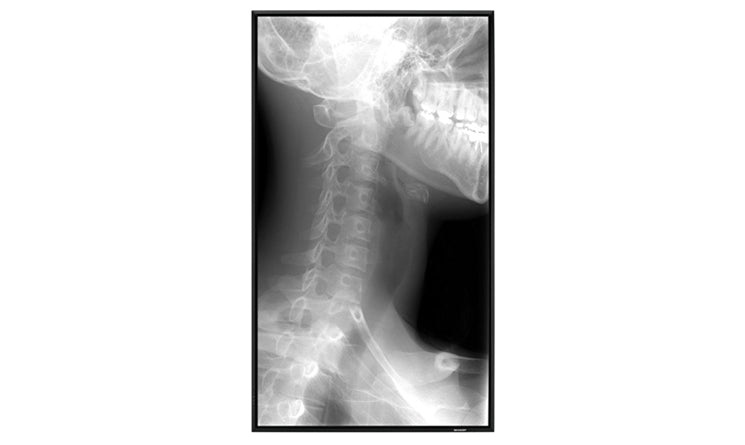 sennheiser-xsw-12-a-wireless-lavalier-microphone-s-shure-blx1288cvlh8-ual-channel-combo-wireless-syst-1