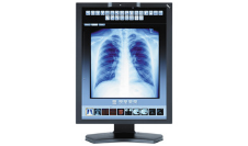 Medical Displays