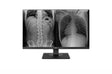 LG 27HJ713C-B 8MP Clinical Review Monitor