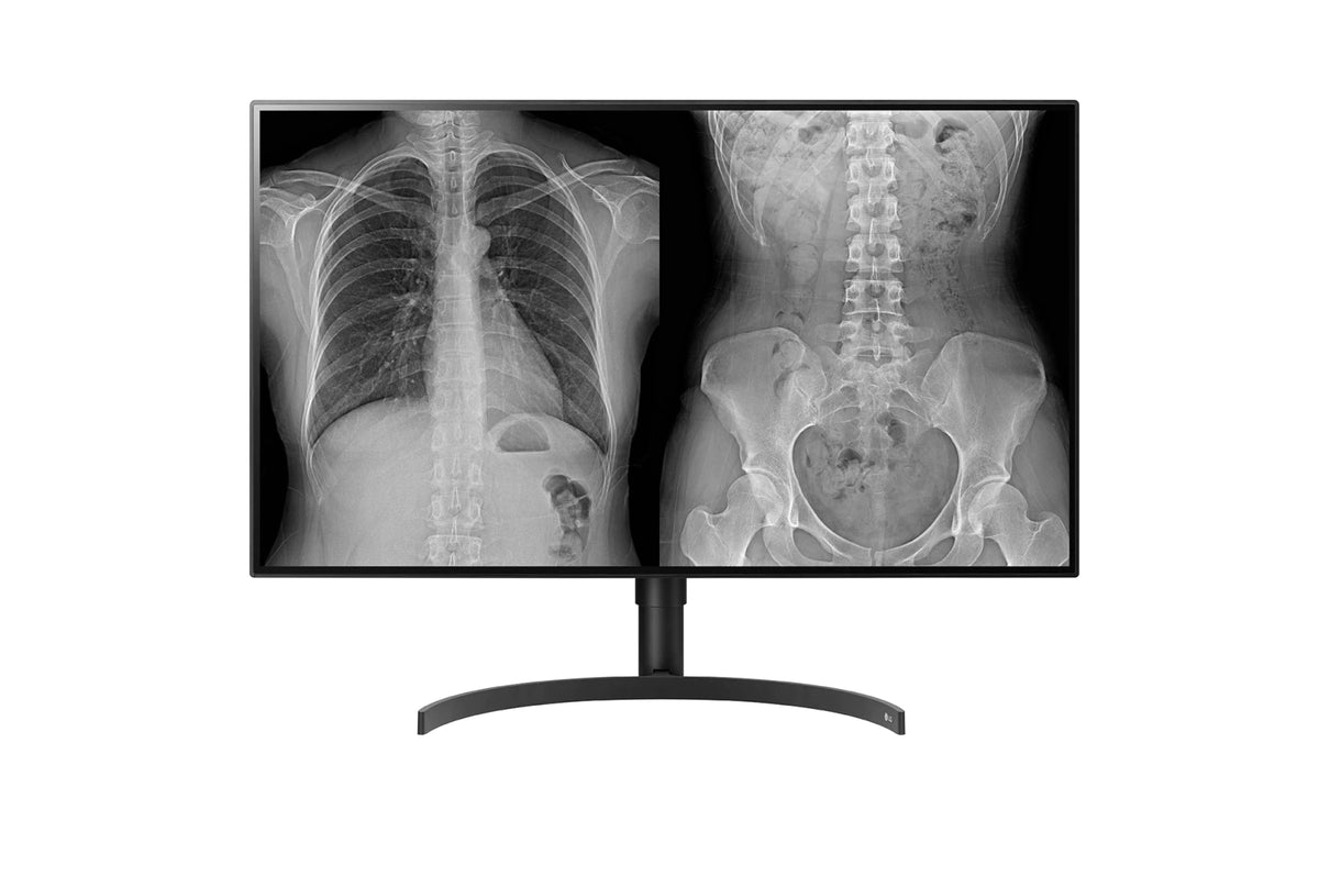 LG 32HL512D-B 32 8MP Color Diagnostic 16 9 4K HDR IPS Monitor