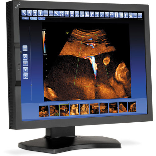 nec-md210c2-213-led-backlit-lcd-medical-monitor-nec-md210c2-213-led-backlit-lcd-medical-monitor-1