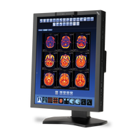 nec-md211c2-213-widescreen-led-backlit-medical-dia
