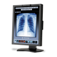 nec-md211c3-213-widescreen-led-backlit-medical-dia