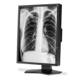 nec-md211g3-21-grayscale-3-megapixel-medical-diagn