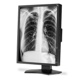 nec-md211g3-21-grayscale-3-megapixel-medical-diagn