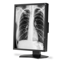 nec-md211g3-21-grayscale-3-megapixel-medical-diagn