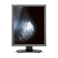 nec-md211g5-n1-21-5mp-medical-mammography-display-