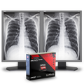 nec-md212g3-21-3mp-medical-diagnostic-monitor-bund
