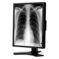 nec-md213mg-21-grayscale-3-megapixel-medical-diagn