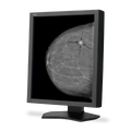 nec-md215mg-213-5-mp-medical-diagnostic-display