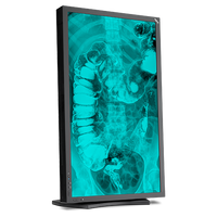 nec-md322c8-315-medical-diagnostic-display-with-le