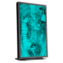nec-md322c8-315-medical-diagnostic-display-with-le