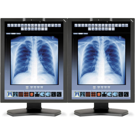 nec-mdc3-bnda1-21-color-medical-diagnostic-monitor-nec-mdc3-bnda1-21-color-medical-diagnostic-monitor