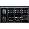 nec-mdc551c8-55-8mp-medical-clinical-color-display