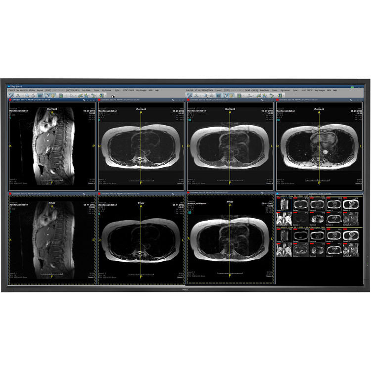 nec-mdc551c8-55-8mp-medical-clinical-color-display