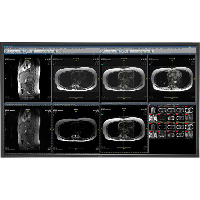 nec-mdc551c8-55-8mp-medical-clinical-color-display