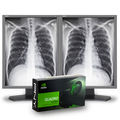 nec-mdg3-bndn2-two-matched-21-grayscale-3mp-medica
